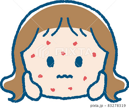湿疹が出た女の子のイラスト 83278319