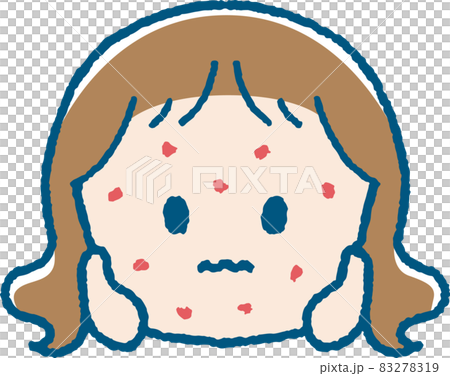 湿疹が出た女の子のイラスト 83278319