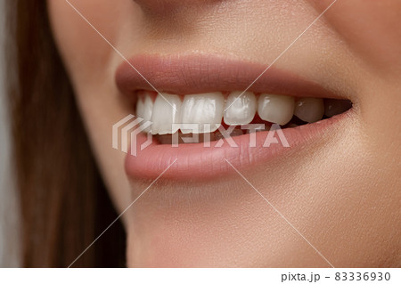 Close-up portrait of beautiful female mouth. Dental care Close-up portrait of beautiful female mouth. Dental care 83336930