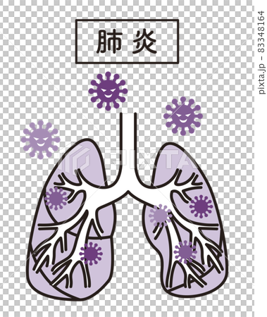 Simple illustration pneumonia 83348164