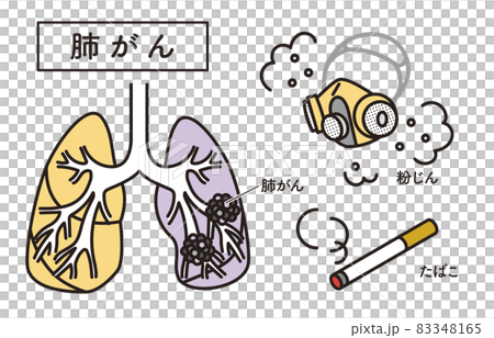 シンプル　イラスト　肺がんの原因　たばこ　粉じん 83348165