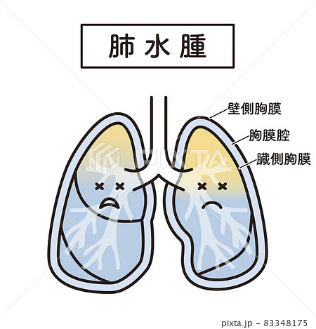 シンプル イラスト 肺水腫の肺のイラスト素材