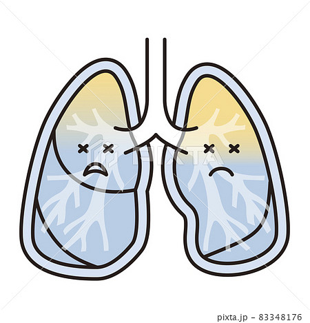 シンプル イラスト 肺水腫の肺のイラスト素材