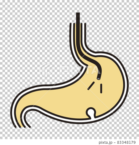 シンプル　イラスト　胃のポリープを発見する胃カメラ 83348179