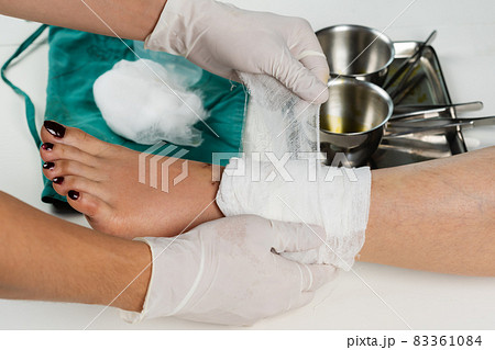 doctor bandaging patient's leg after cleaning wound. 83361084
