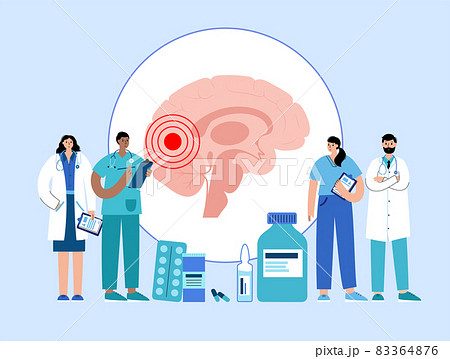 epilepsy seizure or headache 83364876