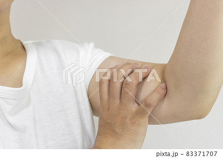 二の腕をつまんでいる女性（日本人、30代、顔無し） 83371707