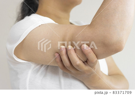二の腕をつまんでいる女性（日本人、30代、顔無し） 83371709