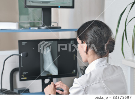 woman radiologist looking at monitor with an x-ray image of a foot. examining and diagnostics of a trauma. rear view of young female x-ray doctor. 83375697
