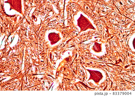 Cerebellum, Thalamus, Medulla oblongata, Spinal cord and Motor Neuron human under the microscope in Lab. Cerebellum, Thalamus, Medulla oblongata, Spinal cord and Motor Neuron human under the microscope in Lab. 83379004