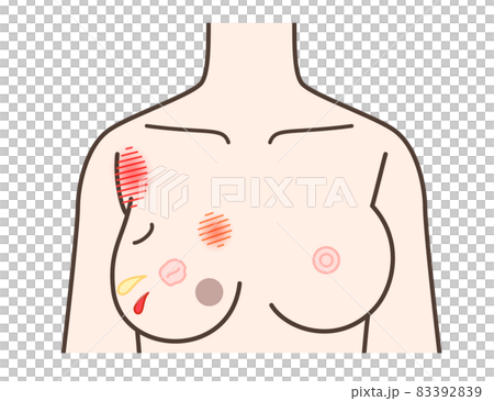 Signs of chest illness Signs of chest illness 83392839