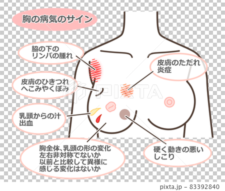 Signs of chest illness Signs of chest illness 83392840
