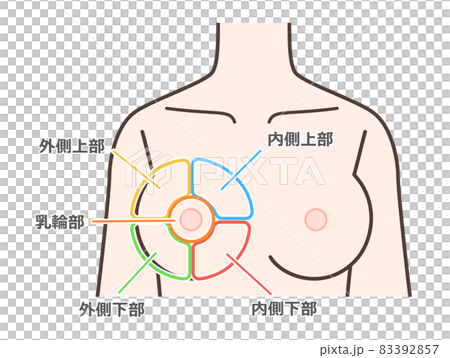 Breast disease classification illustration 83392857
