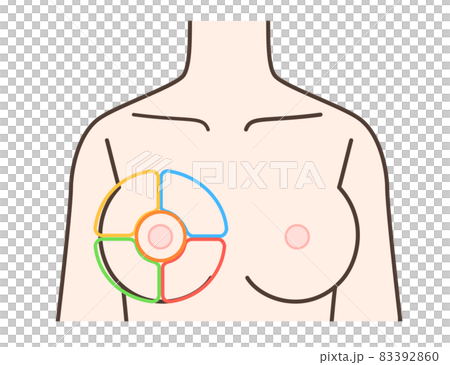 胸の病気の区分けイラスト 胸の病気の区分けイラスト 83392860