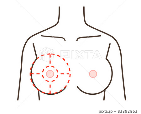 胸の病気の区分けイラスト 83392863
