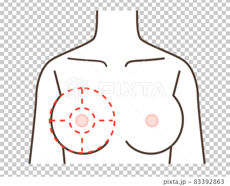 胸の病気の区分けイラスト 83392863