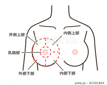 胸の病気の区分けイラスト 胸の病気の区分けイラスト 83392864