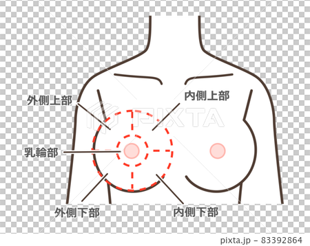 Breast disease classification illustration 83392864