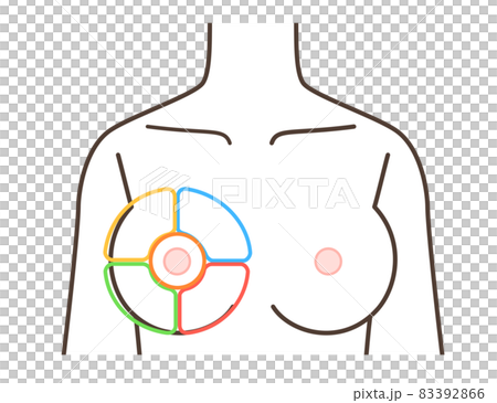 胸の病気の区分けイラスト 胸の病気の区分けイラスト 83392866