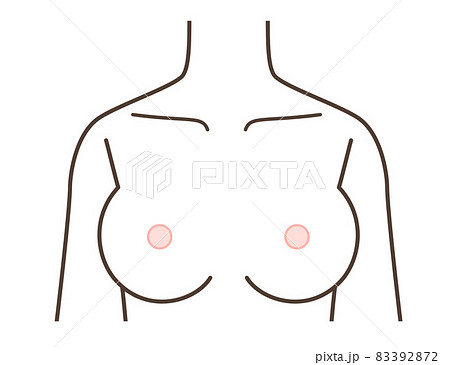 胸のイラスト　豊胸　胸の病気など 83392872