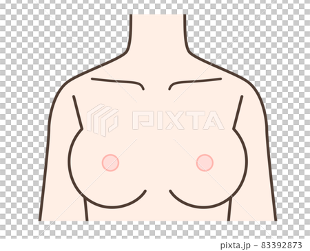 Breast illustrations, breast augmentation, breast diseases, etc. 83392873