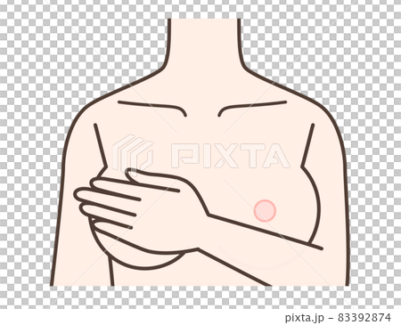 Breast illustrations