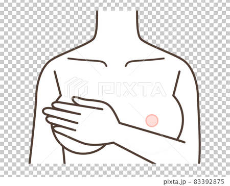 胸のイラスト 豊胸 胸の病気など 胸のイラスト 豊胸 胸の病気など 83392875