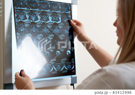 Doctor looking at x-ray image on screen in clinic Doctor looking at x-ray image on screen in clinic 83412996