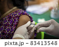 Close-up of doctors, nurses, vaccinating against and treating from coronavirus, covid-19, flu, infection. Medical concept of vaccination. 83413548
