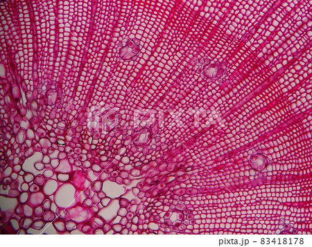 紫に染色されたスギの茎断面図 紫に染色されたスギの茎断面図 83418178