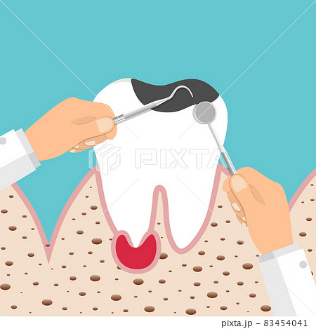 Dentist holding instruments and examining patient teeth. Teeth examination dentistry concept. 83454041
