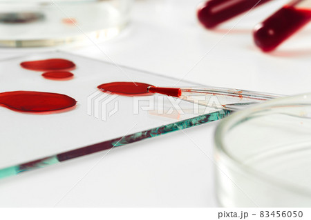 Blood test analysis with Petri dish close up Blood test analysis with Petri dish close up 83456050