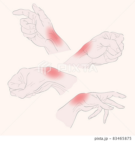 Wrist Pain From Office Syndrome Hand Pain のイラスト素材