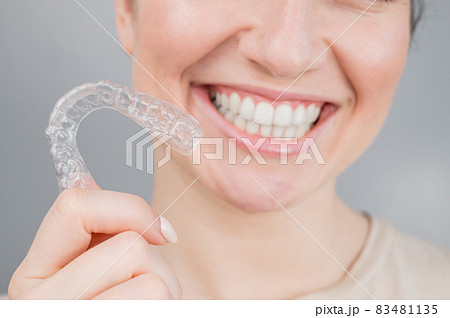 Close-up portrait of a woman putting on a transparent plastic retainer. A girl corrects a bite with the help of an orthodontic device 83481135