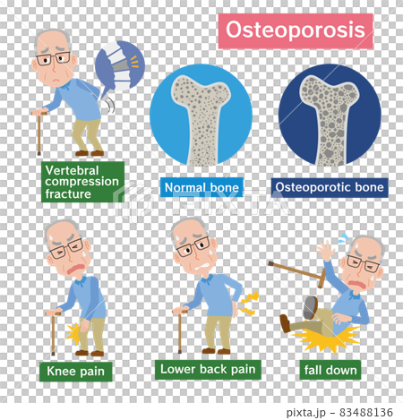 骨粗しょう症のイメージと高齢男性 83488136