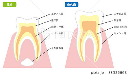 乳歯と永久歯の断面図 83526668