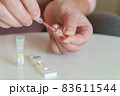 The woman takes a blood sample with a pipette from his finger 83611544