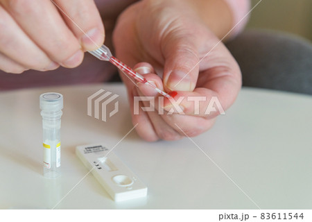 The woman takes a blood sample with a pipette from his finger 83611544