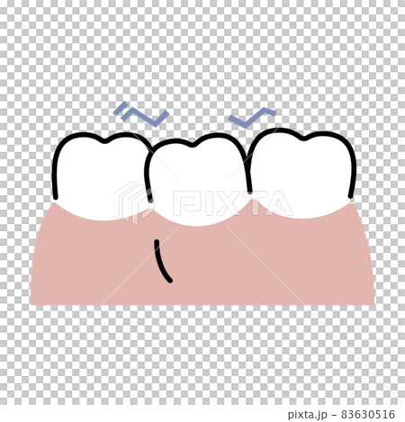 Teeth with poor alignment 83630516