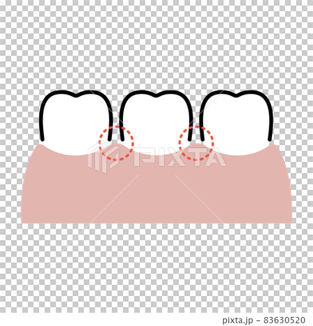 Successful teeth 83630520