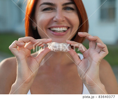 Red-haired Caucasian woman holding transparent mouthguards for bite correction outdoors. A girl with a beautiful snow-white smile uses silicone braces 83640377