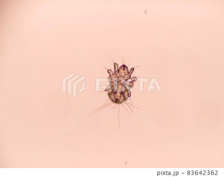 コナダニ コナダニ 83642362