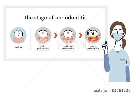 歯周病の進行について説明する女性歯科医（英語ver.） 83661230
