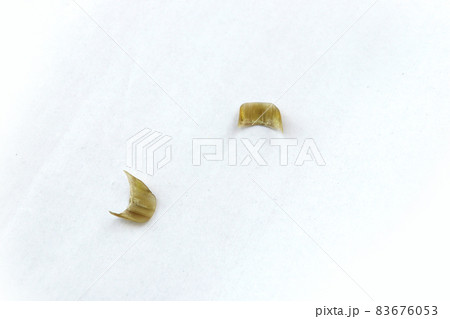 Dirty clipped nails of a man on a white background Dirty clipped nails of a man on a white background 83676053