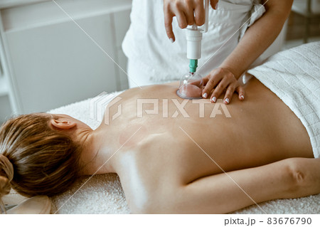 professional female specialist is doing cupping therapy on the back of beautiful caucasian lady 83676790