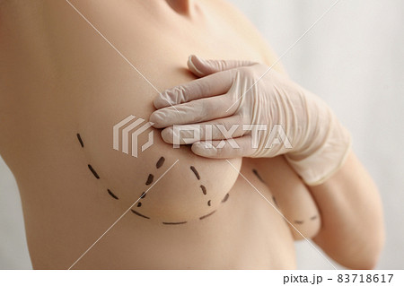 Lines and dots on womans skin Lines and dots on womans skin 83718617