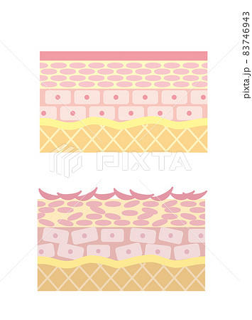 肌断面図2種類のイラスト素材