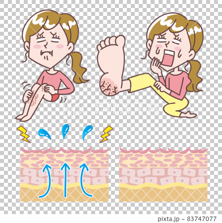 A set of skin cross sections with women suffering from dry skin 83747077