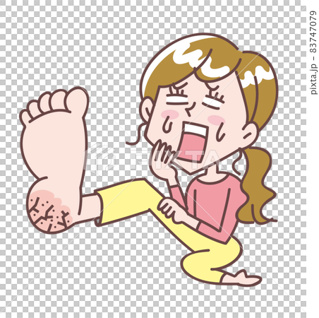 一個令人震驚的腳底破裂的女人 83747079