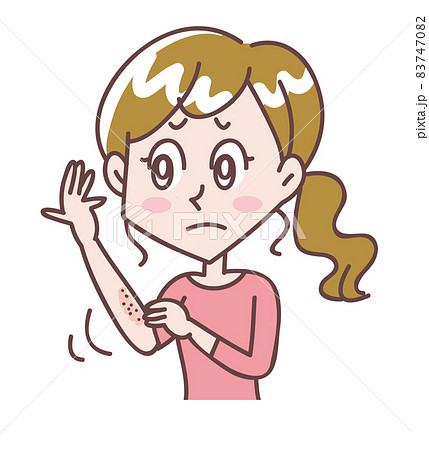 腕が乾燥して痒い女性 83747082